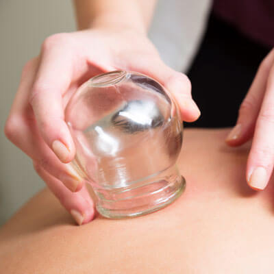 Cupping therapy session easing tight back muscles in Canberra